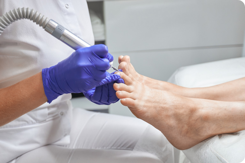 Podología General La Ligua - Cuidado integral de pies, tratamiento de callosidades y hongos